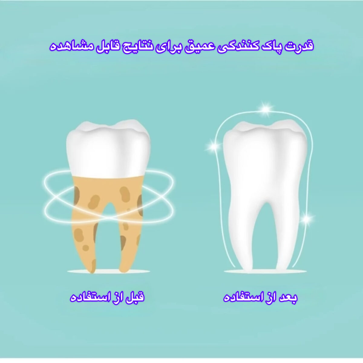 دستگاه جرمگیر دهان و دندان و مدل JYQOO2